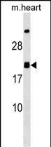 1 - MED9 Antibody (C-term) AP18376b