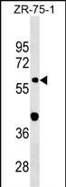 1 - GDPD2 Antibody (Center) AP18406c