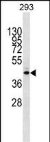 1 - METTL2B Antibody (N-term) AP18416a