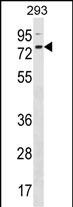 1 - ZNF416 Antibody (C-term) AP18431b
