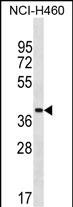 1 - ZNF488 Antibody (Center) AP18433c