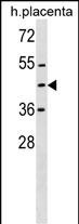 1 - ZNF558 Antibody (Center) AP18434c