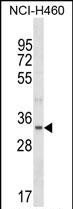 1 - FBLL1 Antibody (Center) AP18446c