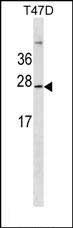 1 - GKN3P Antibody (Center) AP18454c