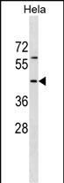 1 - RBM41 Antibody (C-term) AP18492b