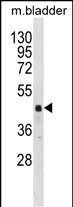 1 - RBM41 Antibody (C-term) AP18492b