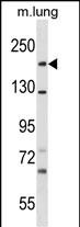 1 - SNED1 Antibody (N-term) AP18493a