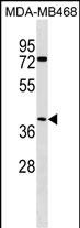 1 - ABHD1 Antibody (C-term) AP18498b