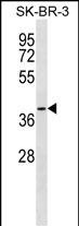 1 - SFXN3 Antibody (C-term) AP18512b