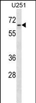1 - ZNF768 Antibody (N-term) AP18531a