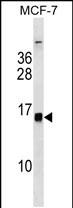 1 - HIST1H2BH/HIST1H2BK/HIST3H2BB Antibody (Center) AP18559c