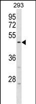 1 - HORMAD1 Antibody (Center) AP18581c
