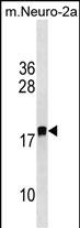 1 - LDOC1L Antibody (C-term) AP18583b