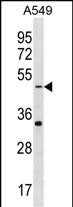 1 - GABRR2 Antibody (N-term) AP18624a