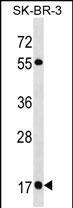 1 - RAB19 Antibody (N-term) AP18630a