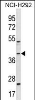 1 - GIPC2 Antibody (C-term) AP18639b