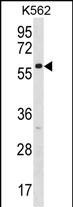 1 - ZNF212 Antibody (N-term) AP18653a