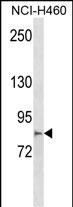 1 - MCTP2 Antibody (N-term) AP18655a