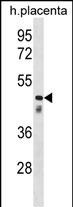 1 - CLUL1 Antibody (C-term) AP18659b