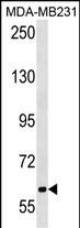 1 - TRPC4AP Antibody (N-term) AP18682a