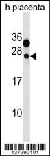 1 - CLEC6A Antibody (C-term) AP18742b
