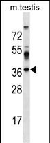 1 - SURF4 Antibody (C-term) AP18750b