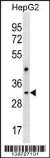 1 - CEP170L Antibody (Center) AP18772c