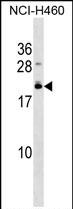 1 - EFCAB10 Antibody (C-term) AP18782b