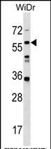 1 - LRRC14B Antibody (N-term) AP18791a