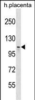 1 - MMS19 Antibody (Center) AP18795c