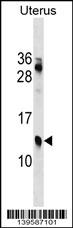 1 - KLKP1 Antibody (N-term) AP18842a
