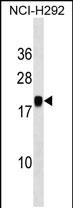 1 - PGSF1 Antibody (Center) AP18854c