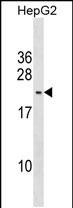 1 - PMS2L5 Antibody (C-term) AP18858b