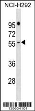 1 - PRAMEF16 Antibody (C-term) AP18863b