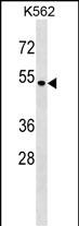 1 - SMAP1 Antibody (N-term) AP18881a