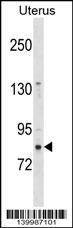 1 - ZNF853 Antibody (N-term) AP18885a
