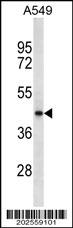 1 - SRD5A2L2 Antibody (C-term) (Ascites) AM2127a