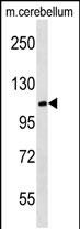 1 - MBD6 Antibody (C-term) AP18913B