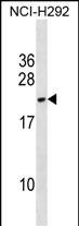 1 - DYDC2 Antibody (C-term) AP18917b