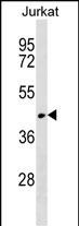 1 - RUNDC3A Antibody (Center) AP18937c