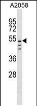 1 - CLEC18C Antibody (C-term) AP18950b