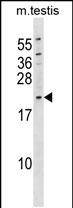 1 - KAP Antibody (Center) AP18954c
