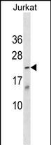 1 - KAP Antibody (Center) AP18954c