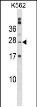 1 - PABPC1L2B Antibody (C-term) AP18962b