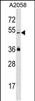 1 - PRAMEL Antibody (Center) AP19026c