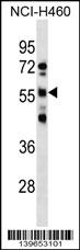 1 - RBMY1D Antibody (C-term) AP19033b