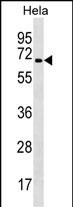1 - TRAF3IP2 Antibody (C-term) AP19044b