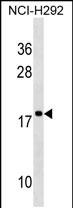 1 - RPS17L Antibody (Center) AP19045c