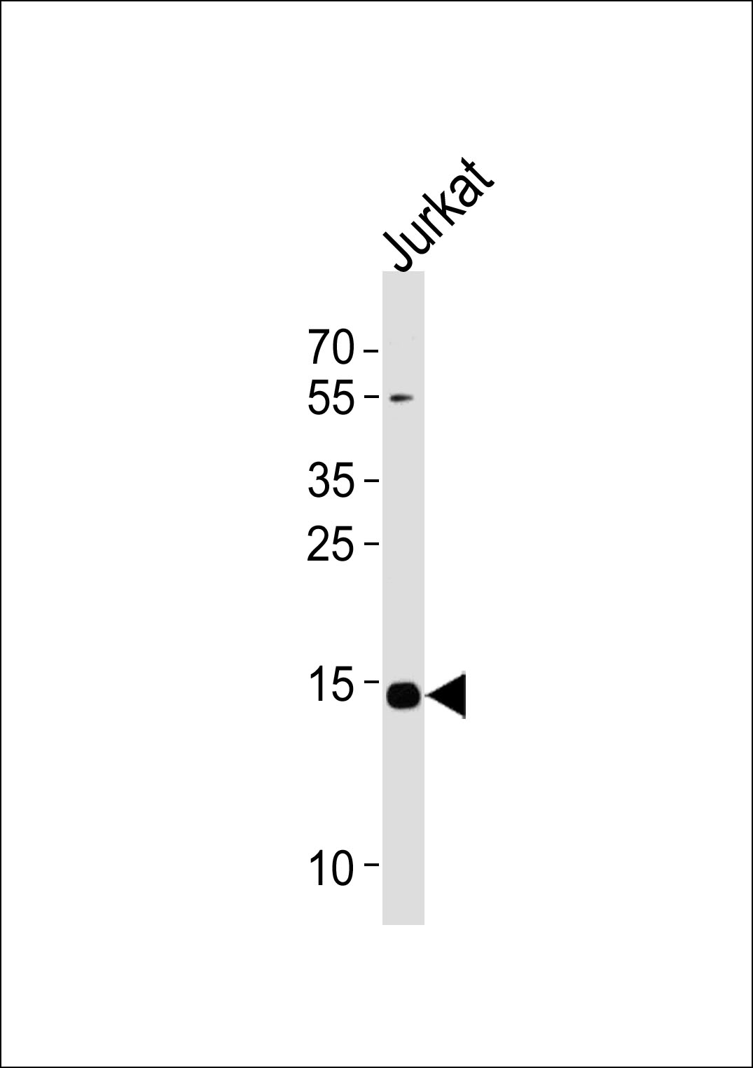 1 - UBE2D4 Antibody (C-term) AP19059b