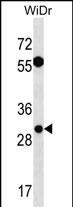1 - EXOSC6 Antibody (N-term) AP19066a